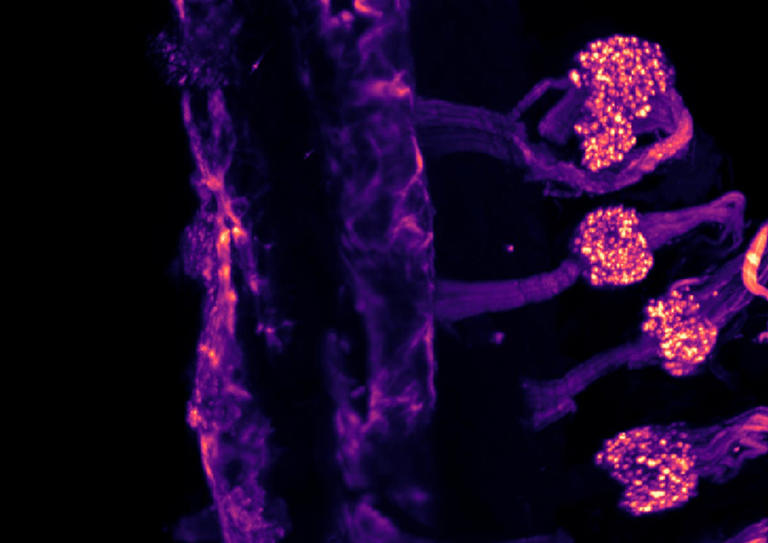 科学家在人体内发现两种不同的冷感受器 皮肤与内脏各司其职